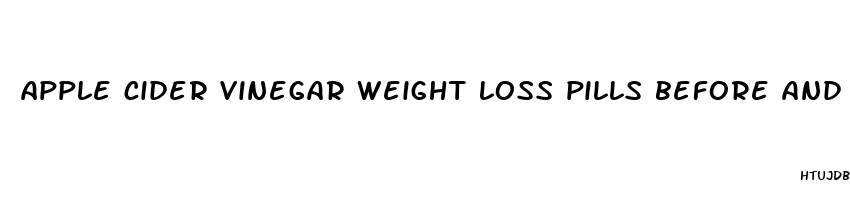 apple cider vinegar weight loss pills before and after