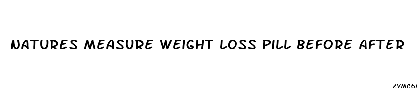 natures measure weight loss pill before after