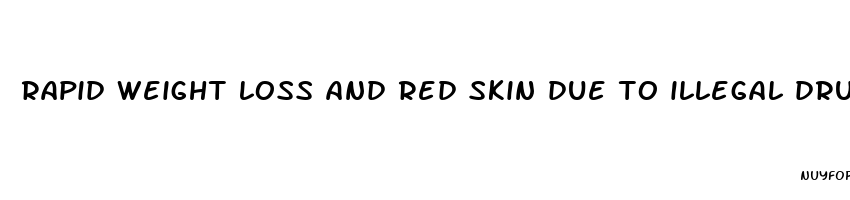 rapid weight loss and red skin due to illegal drugs