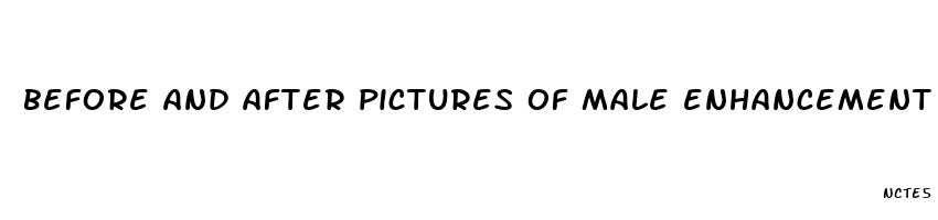 before and after pictures of male enhancement pills