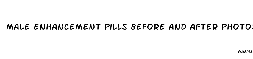 male enhancement pills before and after photos