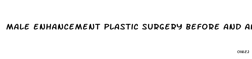 male enhancement plastic surgery before and after