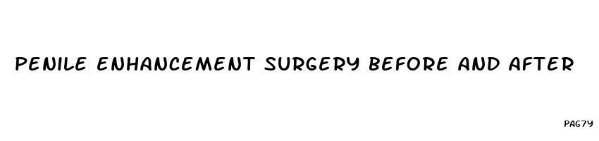 penile enhancement surgery before and after