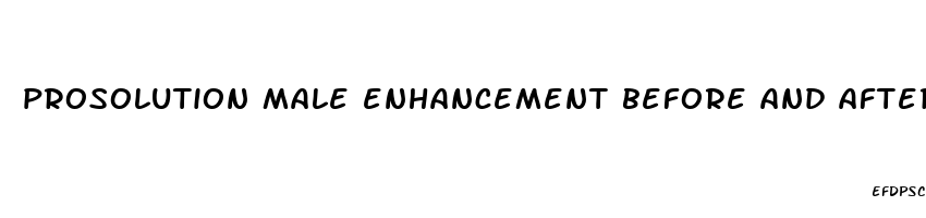 prosolution male enhancement before and after