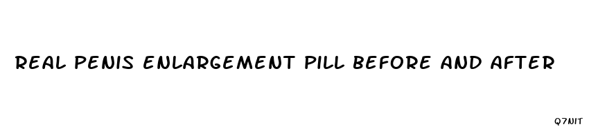 real penis enlargement pill before and after